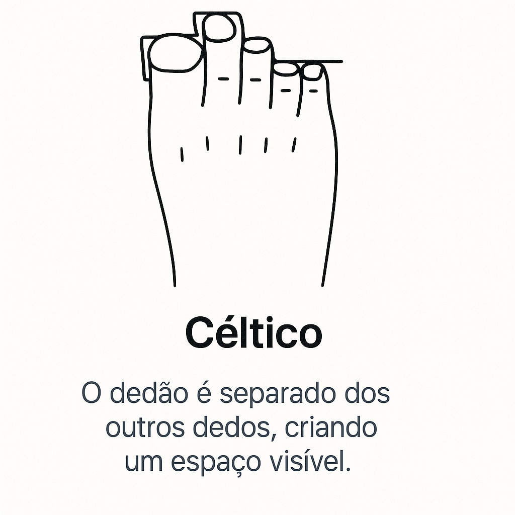 Pé Céltico